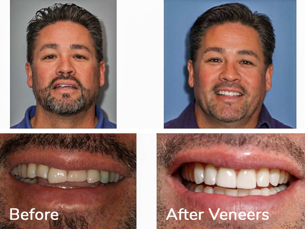 actual patient shows his before and after